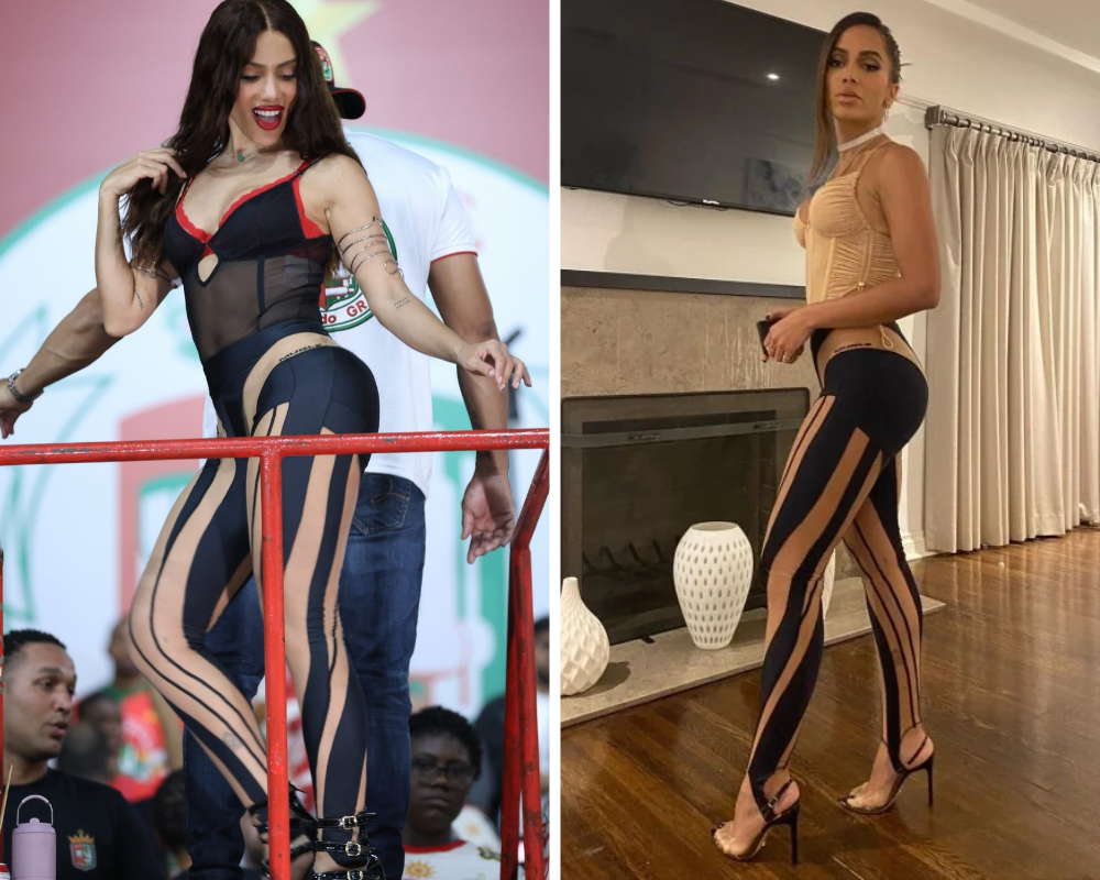 Anitta no ensaio de 2026 e com a legging em 2021 (Fotos: Daniel Pinheiro/BrazilNews/ Reprodução/instagram)